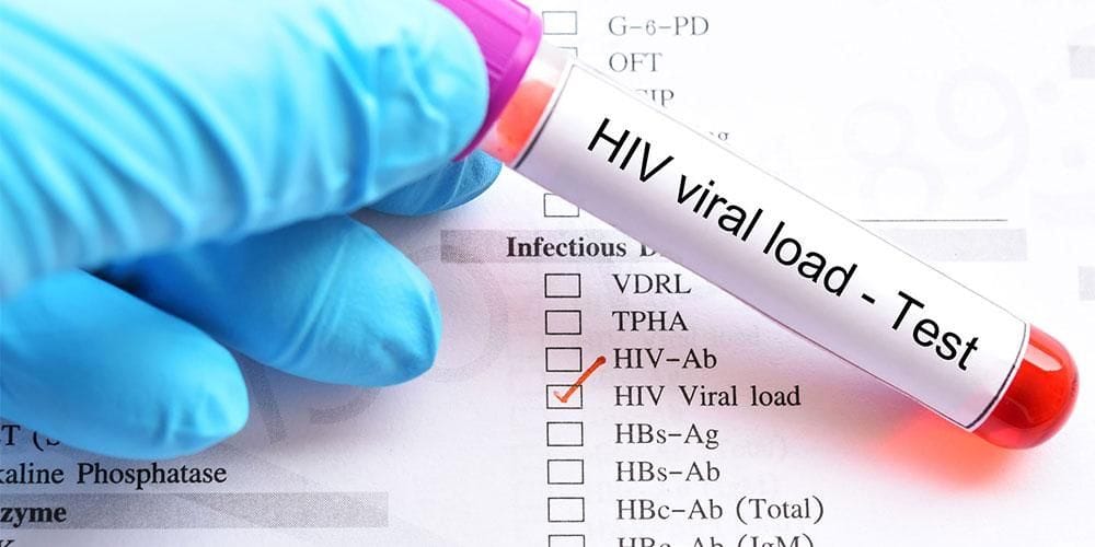 Tes HIV Melalui Pengukuran Viral Load