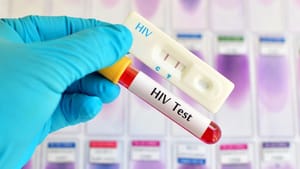Metode Tes HIV: Menguji dan Mendiagnosis Infeksi secara Akurat