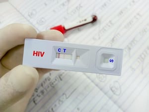 Penyebab HIV Reaktif: Faktor yang Memengaruhi Hasil Tes HIV