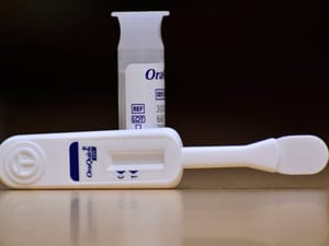Tes HIV Mandiri melalui Oral Fluid Test: Pilihan Tepat untuk Skrining HIV